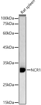 NCR1 Polyclonal Antibody (E-AB-90867)