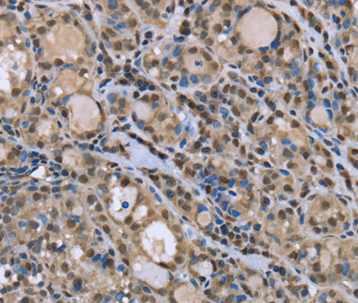 DYNLL1 Polyclonal Antibody (E-AB-14954)