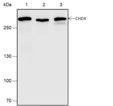 Recombinant CHD4 Monoclonal Antibody (AN301933L)