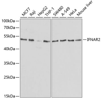 IFNAR2 Polyclonal Antibody (E-AB-67195)