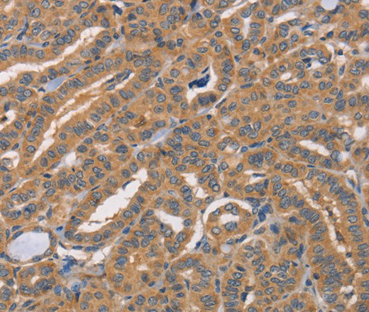 CDCA4 Polyclonal Antibody (E-AB-16332)