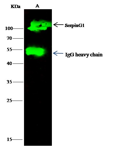 Recombinant SerpinG1/C1 inhibitor/C1IN Monoclonal Antibody (AN300101P)