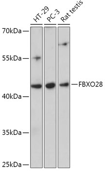FBXO28 Polyclonal Antibody (E-AB-91857)