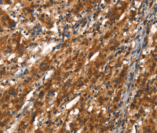 CYP2D6 Polyclonal Antibody (E-AB-13178)
