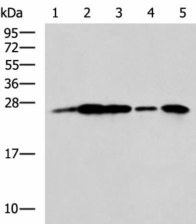 UCHL1 Polyclonal Antibody (E-AB-53097)