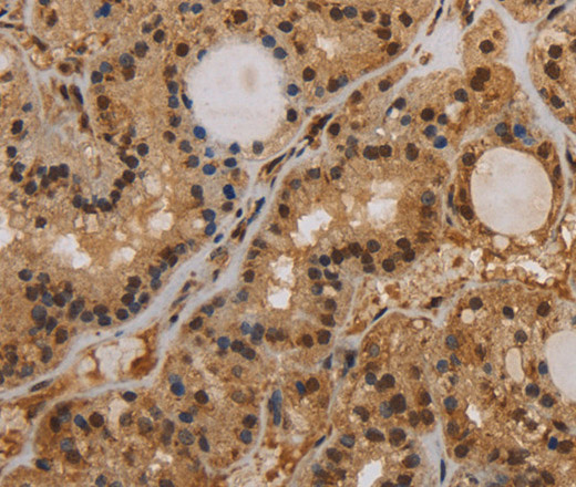 KCNN4 Polyclonal Antibody (E-AB-13359)