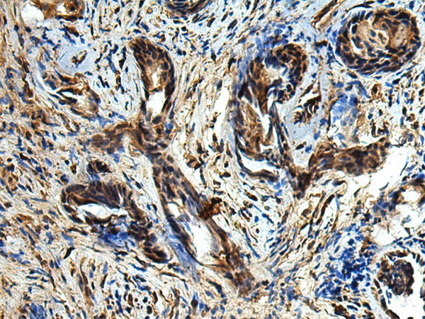 TBCC Polyclonal Antibody (E-AB-53160)