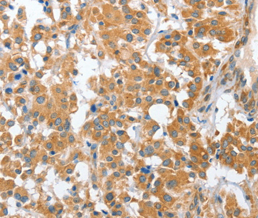 CHMP4B Polyclonal Antibody (E-AB-11081)