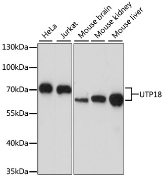 UTP18 Polyclonal Antibody (E-AB-65317)