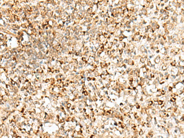 TEX11 Polyclonal Antibody (E-AB-52779)