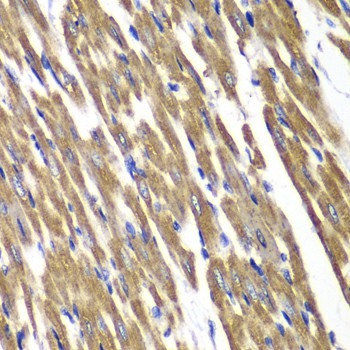 SDHA Polyclonal Antibody (E-AB-60756)