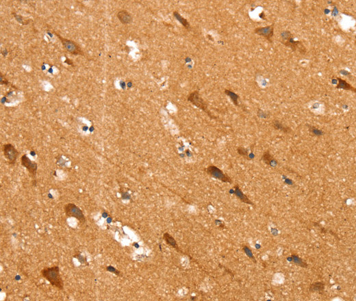 SLC25A12 Polyclonal Antibody (E-AB-13637)