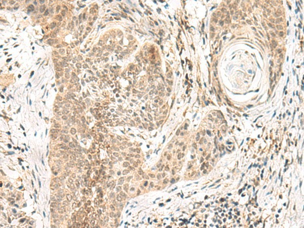 GPSM1 Polyclonal Antibody (E-AB-18834)