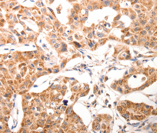 BGLAP Polyclonal Antibody (E-AB-15530)