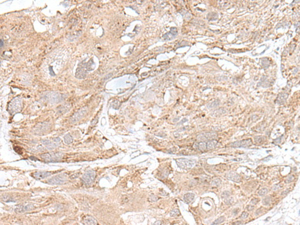 SNRNP25 Polyclonal Antibody (E-AB-18770)