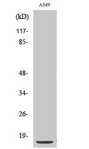 S100A1 Polyclonal Antibody (E-AB-32841)