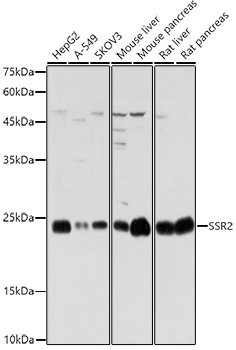 SSR2 Polyclonal Antibody (E-AB-92247)