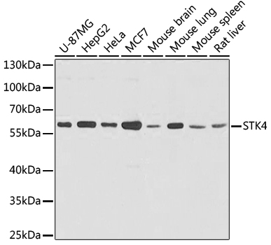 (KO Validated) STK4 Polyclonal Antibody (E-AB-62228)