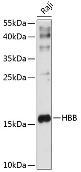 HBB Polyclonal Antibody (E-AB-90630)