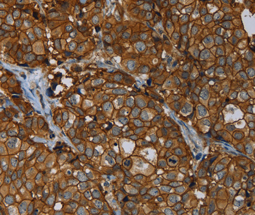 ERBB4 Polyclonal Antibody (E-AB-13998)