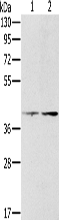 PDGFRL Polyclonal Antibody (E-AB-11477)