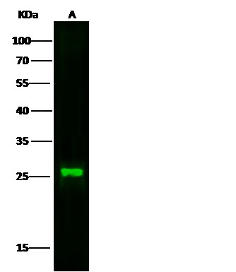 Cystatin 7/CST7 Monoclonal Antibody (AN200167P)