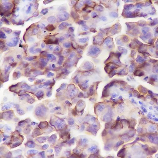 Recombinant NaPi2b Monoclonal Antibody (AN301608L)