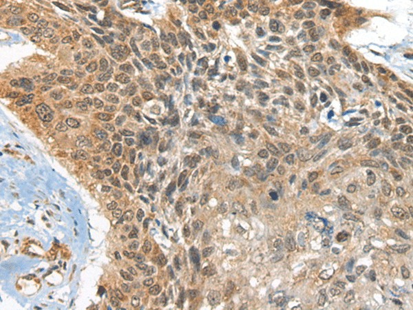 BOLA1 Polyclonal Antibody (E-AB-18542)