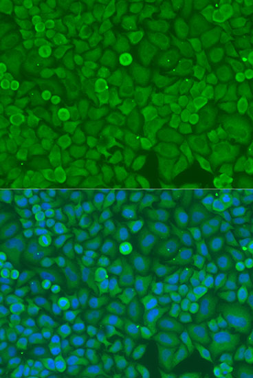 DICER1 Polyclonal Antibody (E-AB-66581)