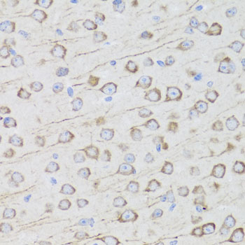 MIP Polyclonal Antibody (E-AB-60792)