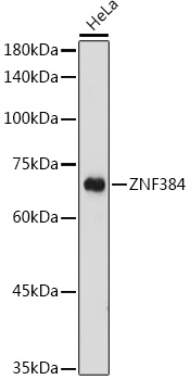 ZNF384 Polyclonal Antibody (E-AB-91377)