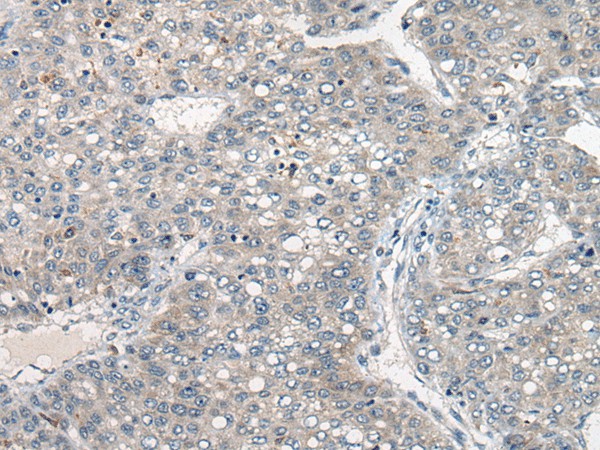 DGKI Polyclonal Antibody (E-AB-17825)