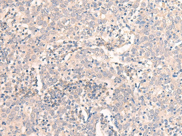 EMX1 Polyclonal Antibody (E-AB-19803)