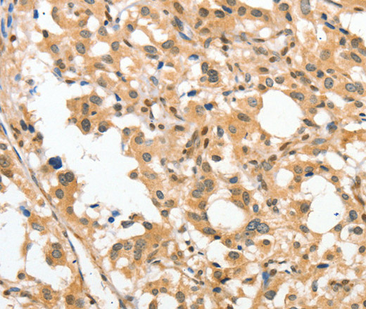 APTX Polyclonal Antibody (E-AB-10820)