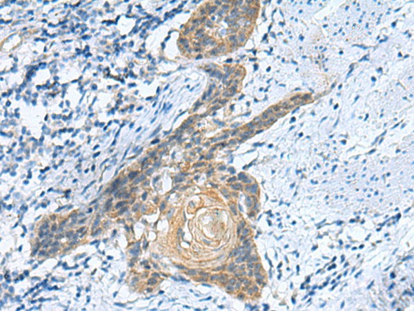 GINS3 Polyclonal Antibody (E-AB-19175)