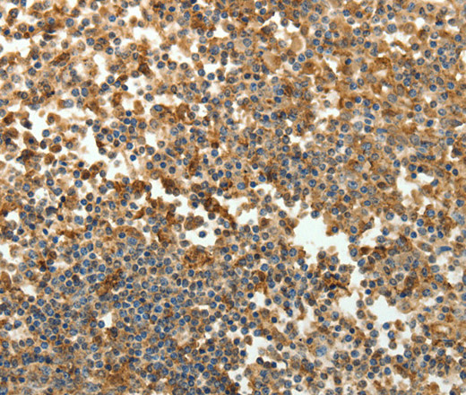 SFTPD Polyclonal Antibody (E-AB-10613)