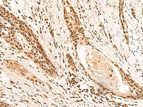 RMND5B Polyclonal Antibody (E-AB-18705)