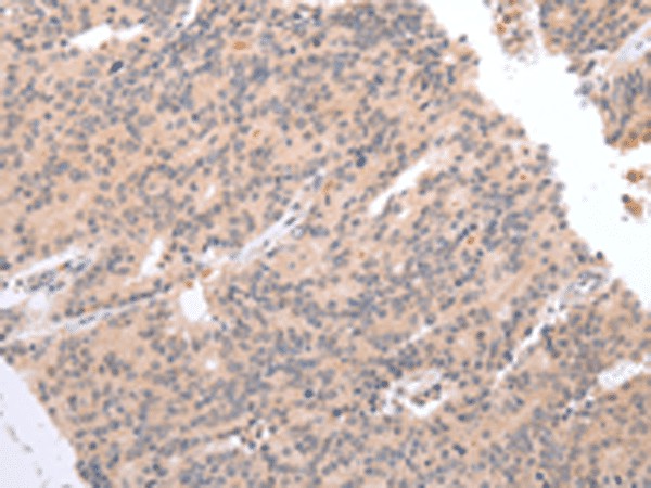 DEFB112 Polyclonal Antibody (E-AB-19385)