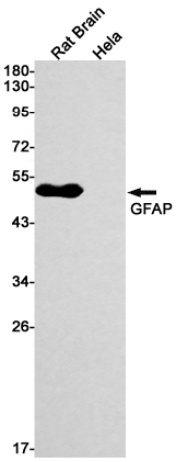 Recombinant GFAP Monoclonal Antibody (E-AB-81560)