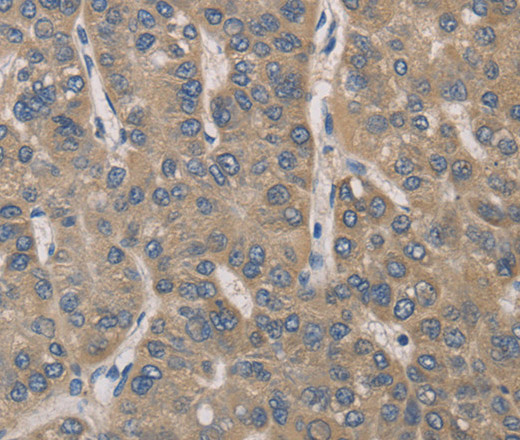 IRAK4 Polyclonal Antibody (E-AB-10409)