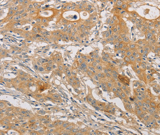 ARSK Polyclonal Antibody (E-AB-14631)