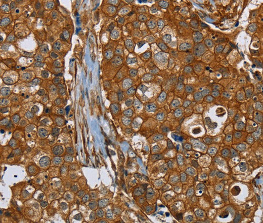 PLEC Polyclonal Antibody (E-AB-16719)