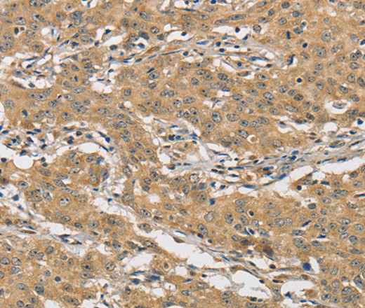 AMZ2 Polyclonal Antibody (E-AB-14598)