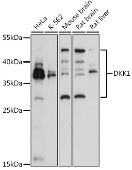 DKK1 Polyclonal Antibody (E-AB-92475)