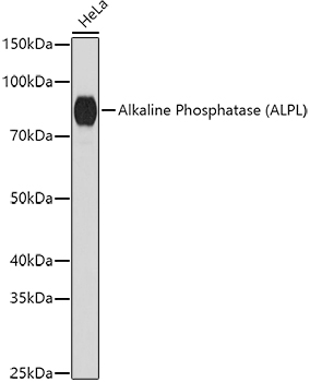 Alkaline Phosphatase (ALPL) Polyclonal Antibody (E-AB-93077)