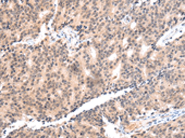 COX17 Polyclonal Antibody (E-AB-53364)
