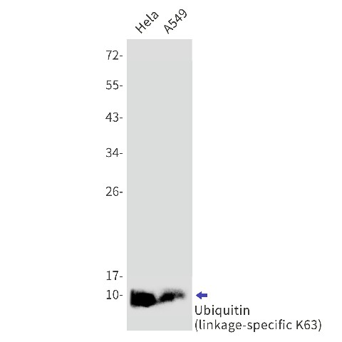 Recombinant Ubiquitin K63 Monoclonal Antibody (E-AB-81618)
