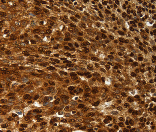 SCN1A Polyclonal Antibody (E-AB-16049)