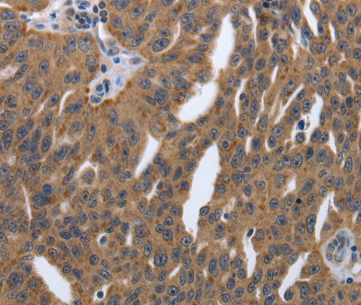 PDGFA Polyclonal Antibody (E-AB-16030)