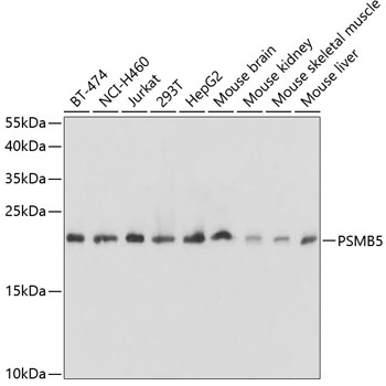 PSMB5 Polyclonal Antibody (E-AB-60532)